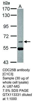 GTX113331 - Méret : 100 µl - Anti-PARP3 Nyúl Poliklonális Antitest - Minden (100microliters)