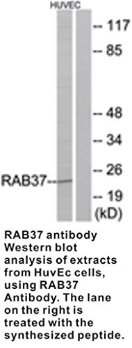 GTX87674 - - Anti-RAB37 Nyúl Poliklonális Antitest - Minden (100 µg)