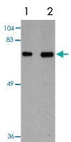 PAB16571 - - Anti-TOMM70A Nyúl Poliklonális Antitest - Minden (100 µg)